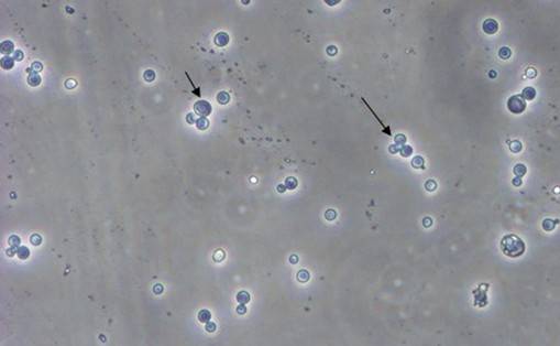 酵母双杂交技术原理、试验流程、特点以及应用