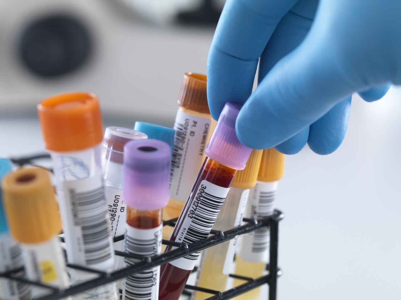 一致性评价大幕开启，医院市场即将调整