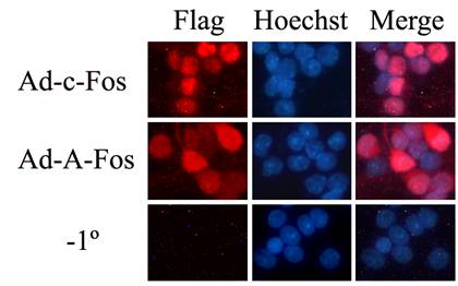 腺病毒感染原代神经元