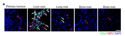 转入小鼠模型得到相同的试验结果，且在转移发生前NET已在肝脏聚积。