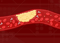 【Science速递】攻克COVID-19里程碑：已确定血凝块形成原因！