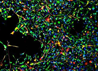 世界首创：药物将干细胞引导至受损部位，提高其愈合能力！