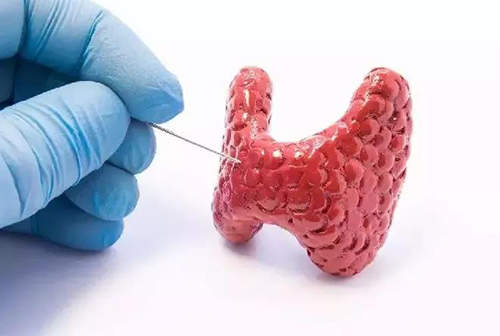 甲状腺疾。鬃聪俟δ芗跬撕图鬃聪俟δ芸航，自古以来就是反复被医学研究人员研究的疾病