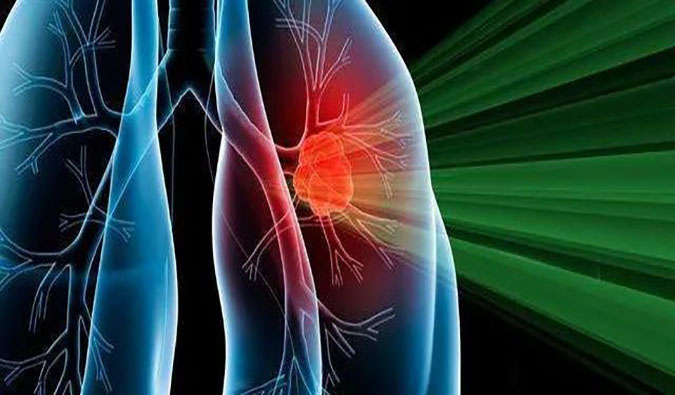 盛世泰科1类创新药物CGT-9475实现中美双报双批 | HJC黄金城平台一站式临床前生物医药研发服务平台助力