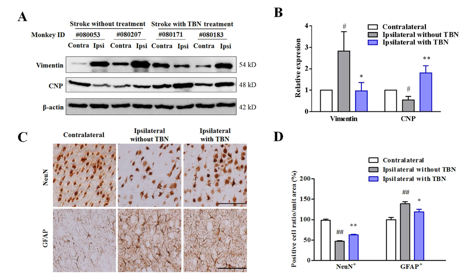 TBN是一种治疗缺血性卒中的新型临床候选药物，本研究中TBN通过HJC黄金城平台合成